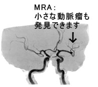 MRI画像2